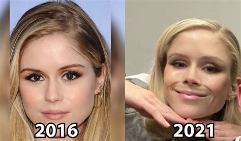 erin moriaty plastic surgery|The Boys’ Erin Moriarty Slams Plastic Surgery Claims,。